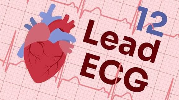 ECG